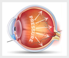 Close-up of an eye